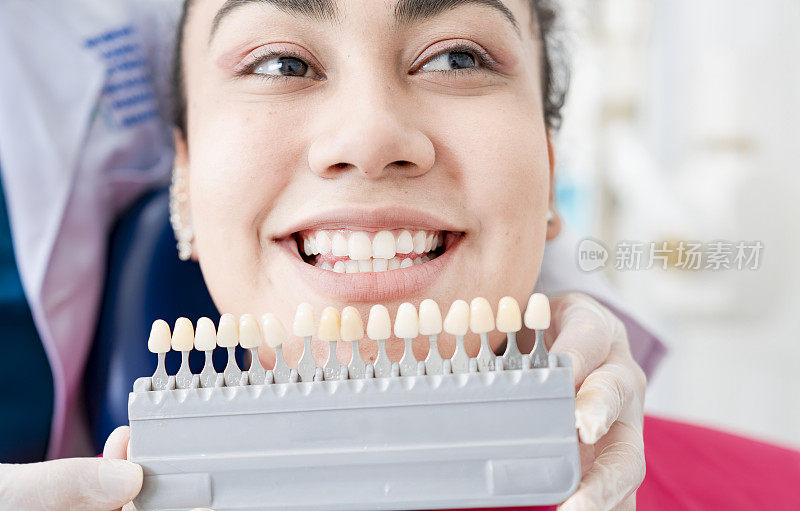 牙医拿着一套不同色调的种植体。病人选择种植体的颜色。种植牙罩的选择，牙医向病人展示种植牙罩