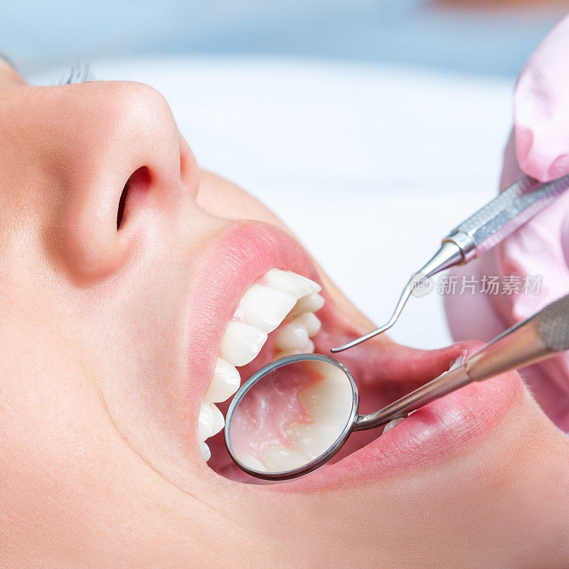 详细的人类牙齿与牙科设备。
