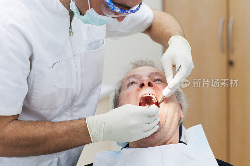 牙科医生的老病人…牙科医生正在给病人拔牙