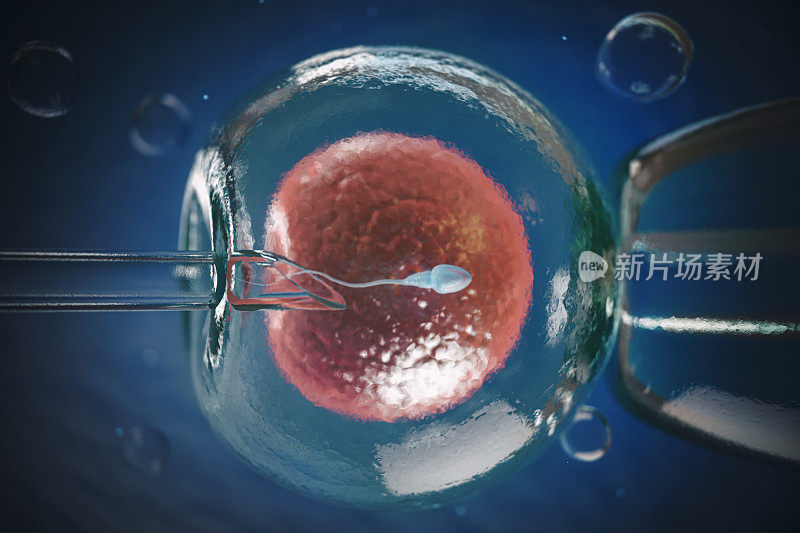 人工授精，体外受精对人类卵细胞的体外受精或生育治疗。