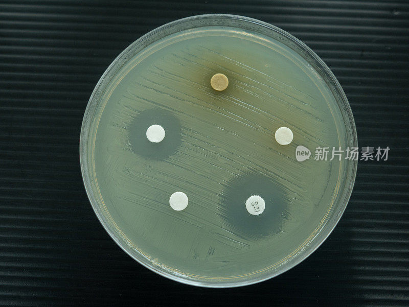 在实验室检查抗生素的培养皿的特写镜头。