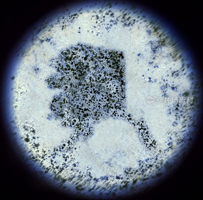 通过显微镜观察阿拉斯加形状的细菌。(系列)