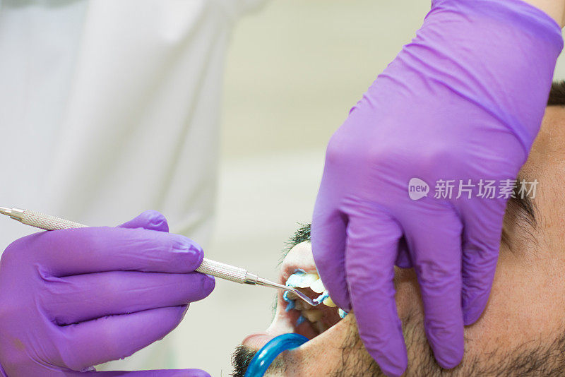 在牙医那里检查牙齿的男人