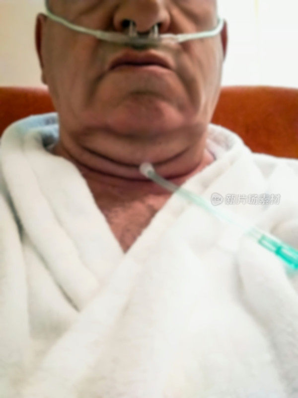 老人采取氧疗治疗程序。病人鼻子里插着塑料管