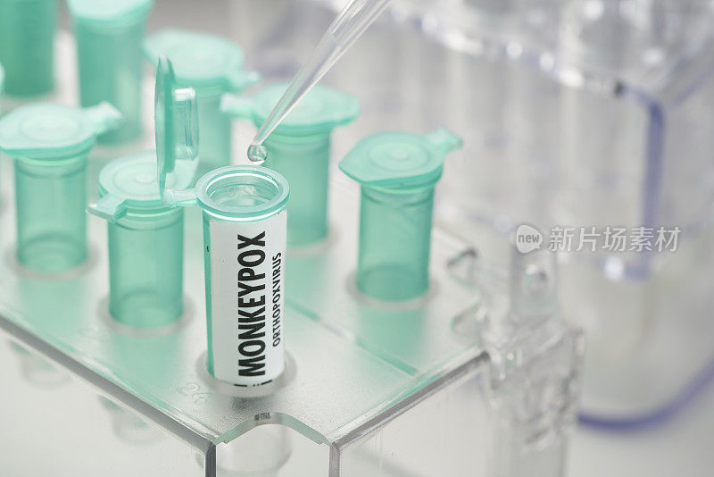 实验室小瓶猴痘病毒。移液管和试管