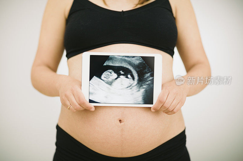 孕妇和超声波图像在平板电脑