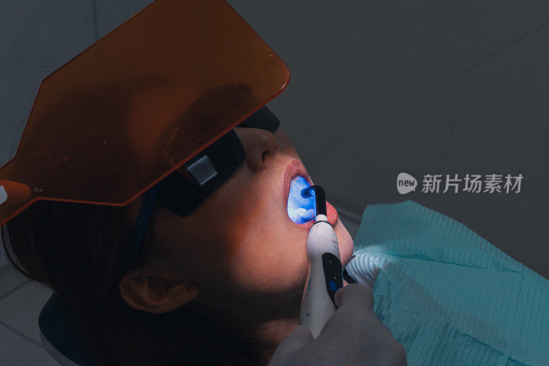 牙医用发出蓝光的牙齿聚合灯制作牙齿填充物