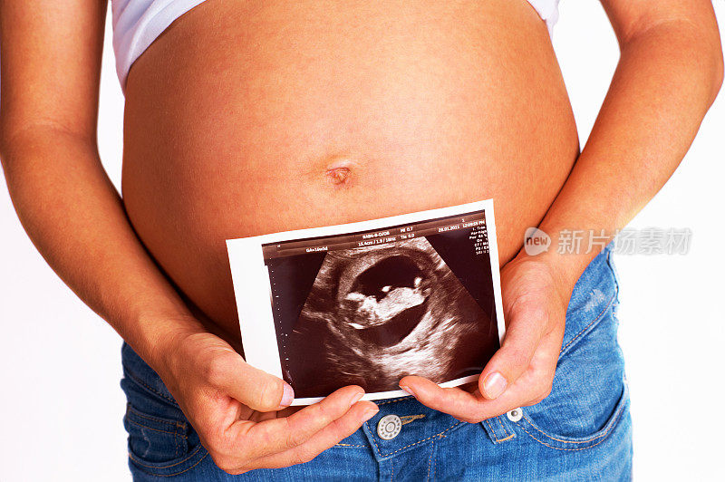 一个美丽的怀孕腹部的特写扫描