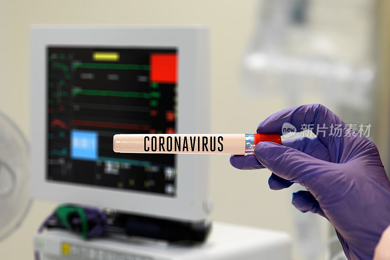 医生在医院拿着冠状病毒试管