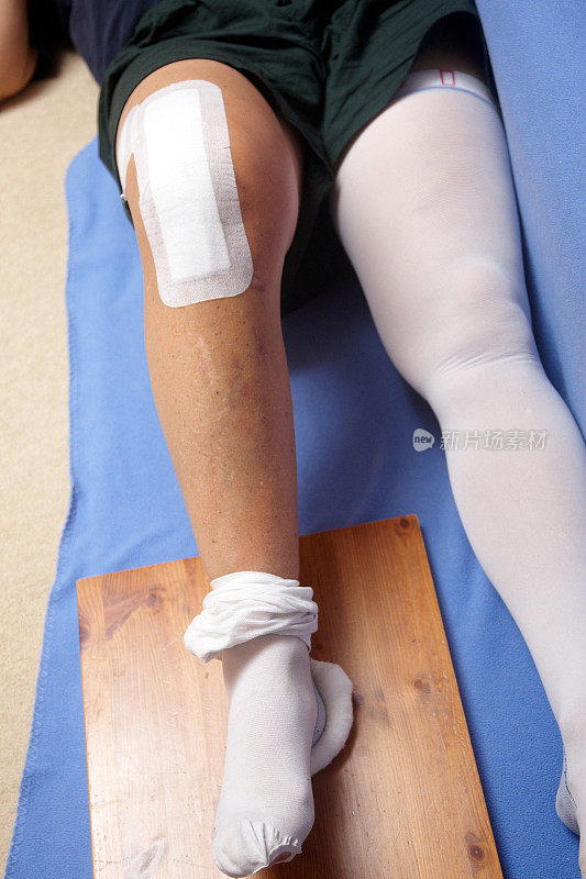 全膝关节置换术患者运动的特写