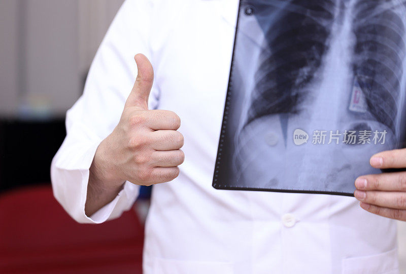 放射科医生正在检查肺部躯干x光片