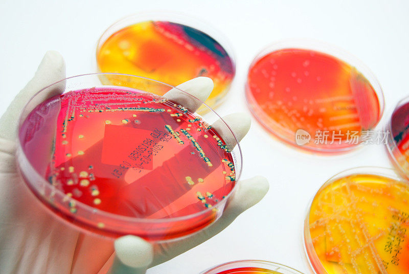 微生物学:彩色细菌培养