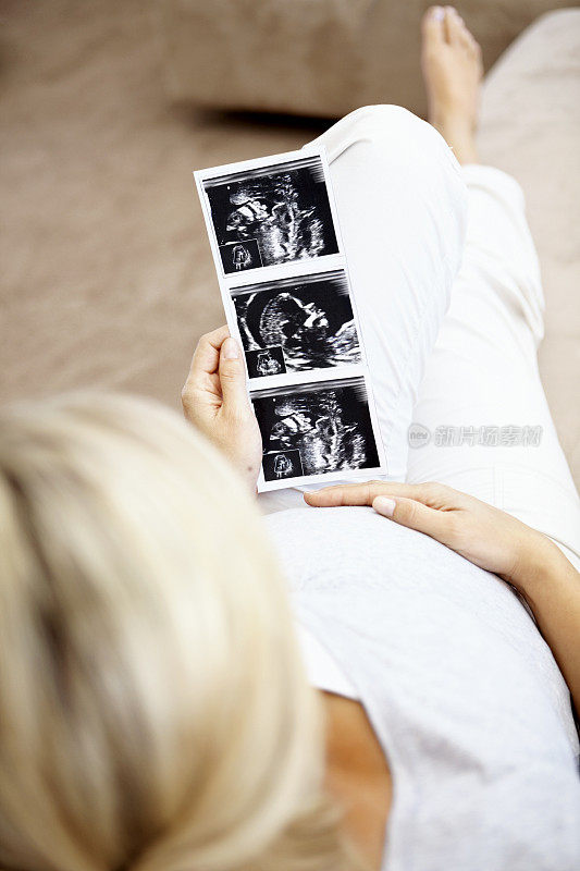 抱着胎儿超声波图的孕妇