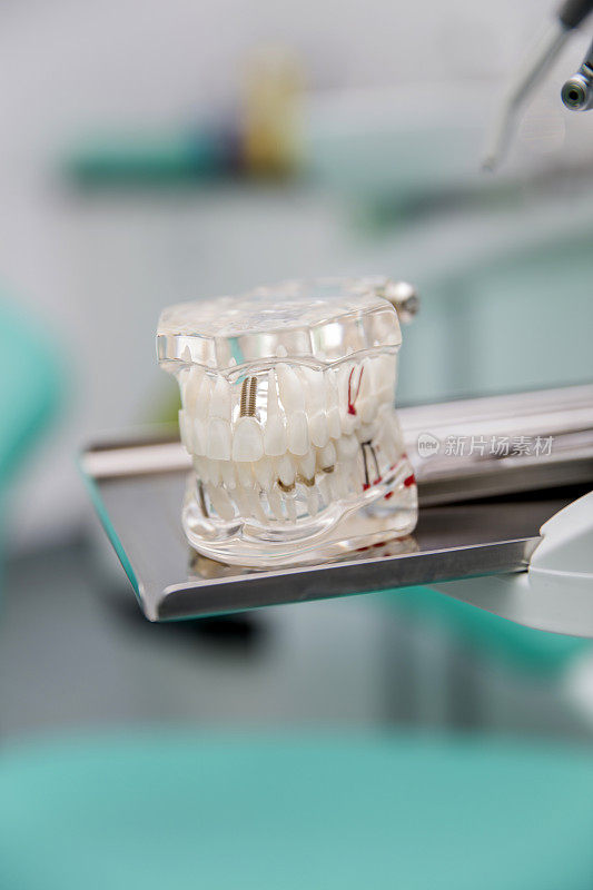 牙科诊所的模型假牙