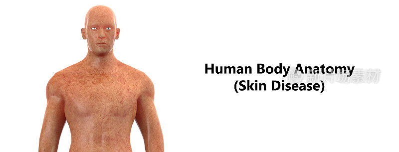 人体皮肤病解剖