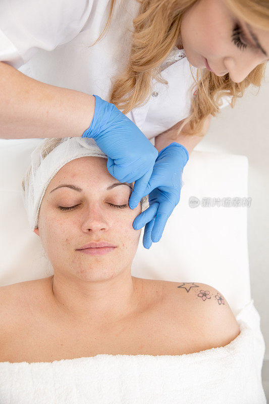 在微晶磨皮治疗后，皮肤科医生在病人脸上涂凡士林