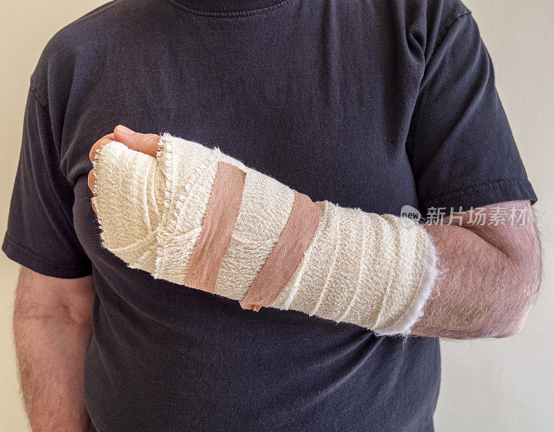 男子腕管手术后包扎的手腕