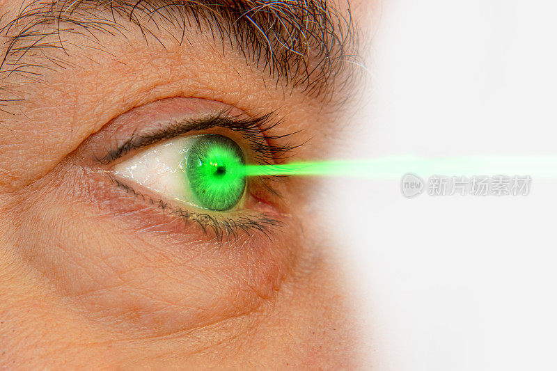 眼科激光治疗的概念。绿色激光束和眼睛特写…