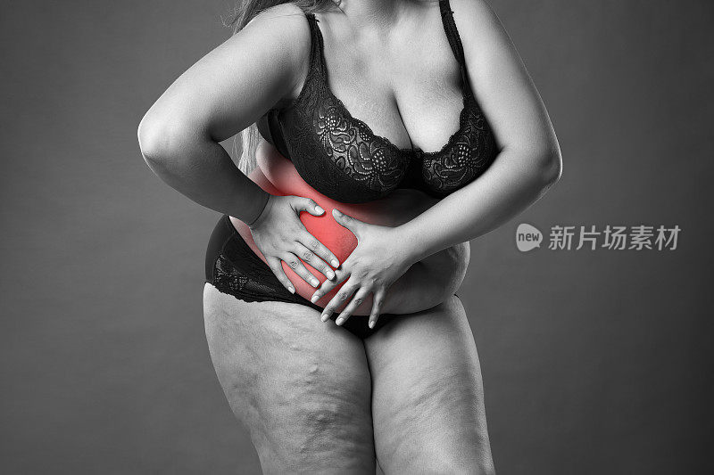 肥胖女性患阑尾炎发作，腹痛、胃痛，女性身体超重