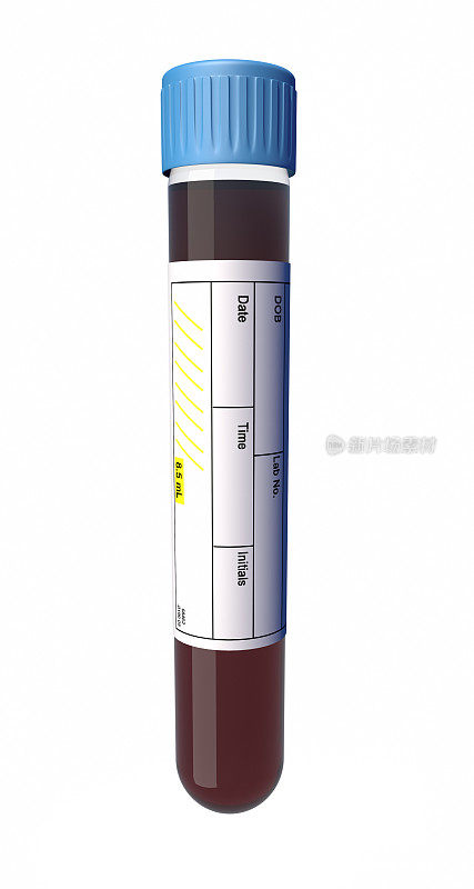 带医学标签的小瓶血液样本