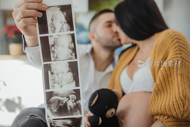 男子抱着未出生婴儿的超声波，亲吻他怀孕的妻子