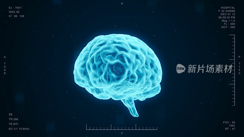 人脑医学诊断接口、未来ct扫描全息图科研技术、AI电脑屏幕三维渲染