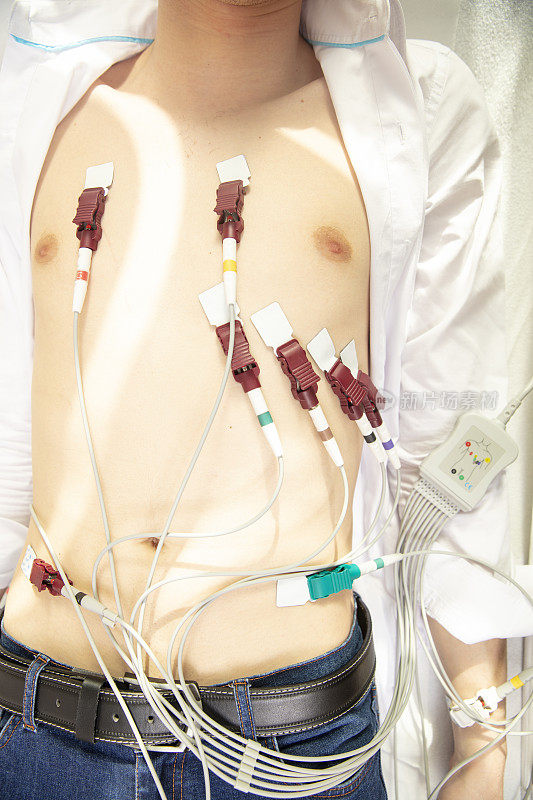 护士将电极放在病人身上做心电图