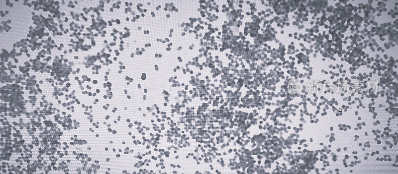 脑膜炎球菌性脑膜炎患者脑脊液的显微镜显示黑白