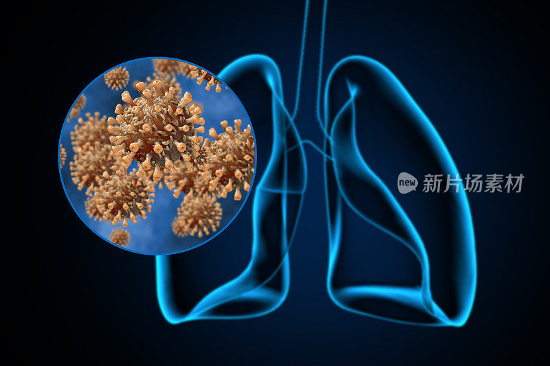 冠状病毒对肺部