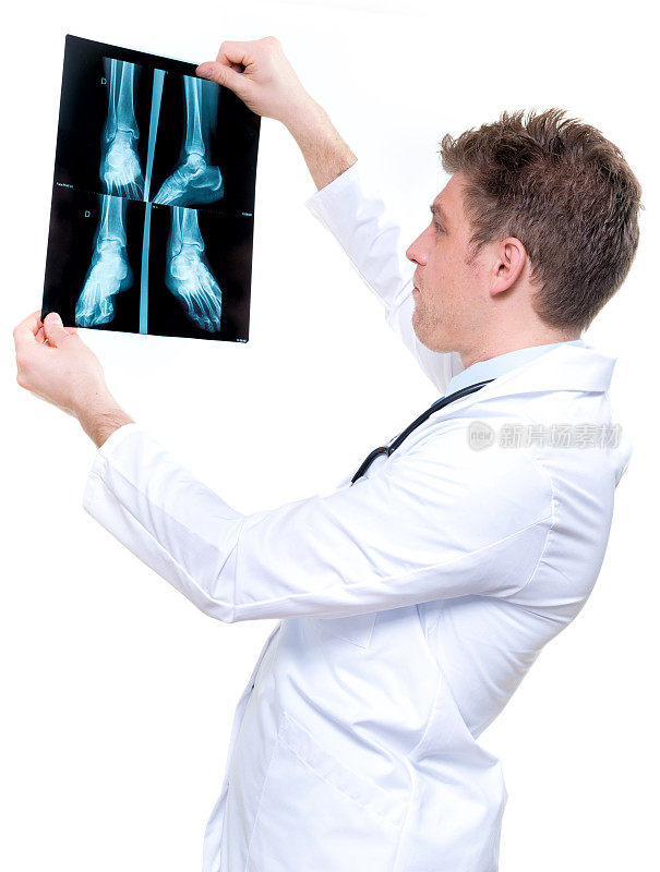 迷人而富有表情的医生拿着x光片