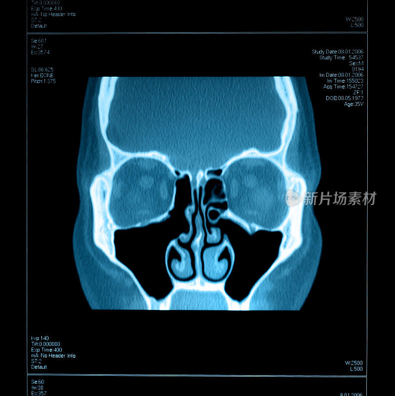 图中显示窦