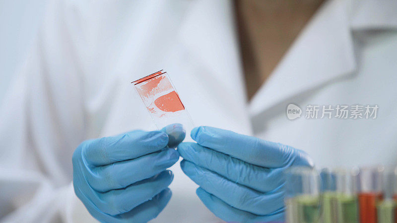 医务人员分析微生物样本、血液样本、HIV检测
