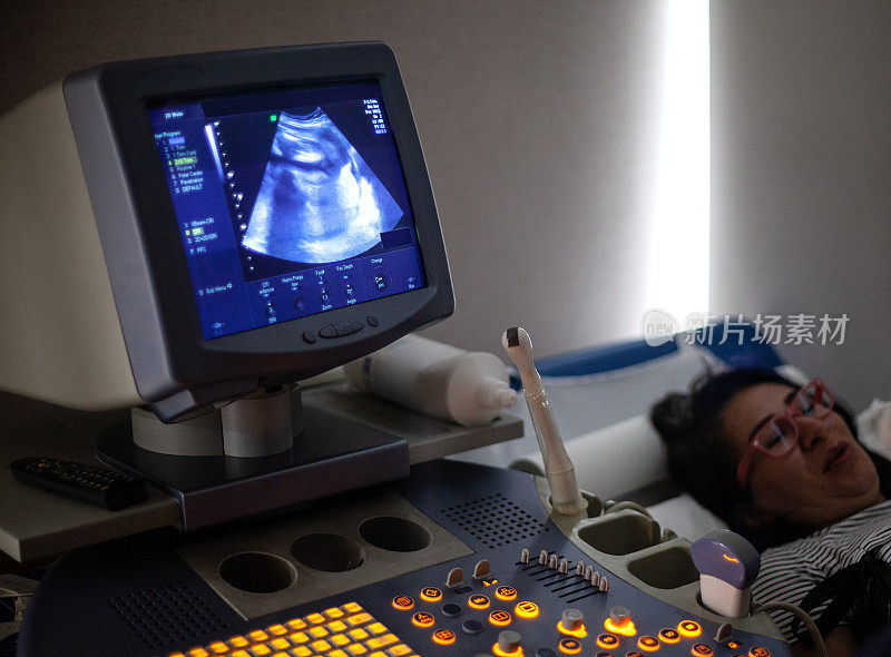 超声检查(即超声)机器与胎儿屏幕在医院