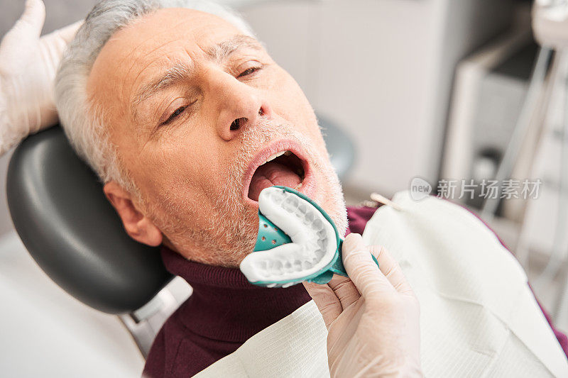 牙科医生在病人口腔上印上牙印