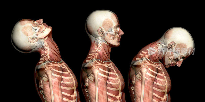 人体解剖，显示颈部损伤，如颈部鞭伤