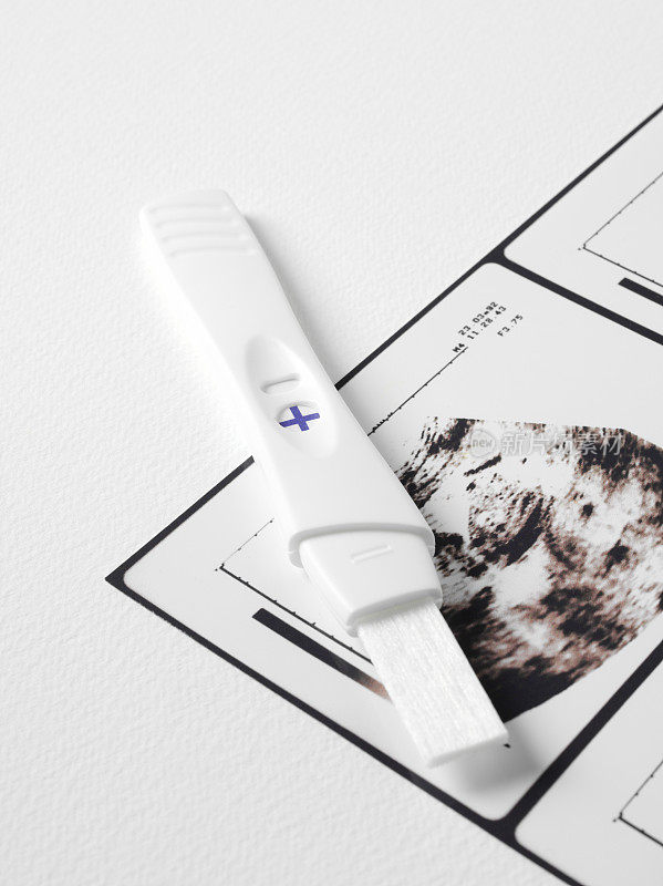 孕检和婴儿扫描