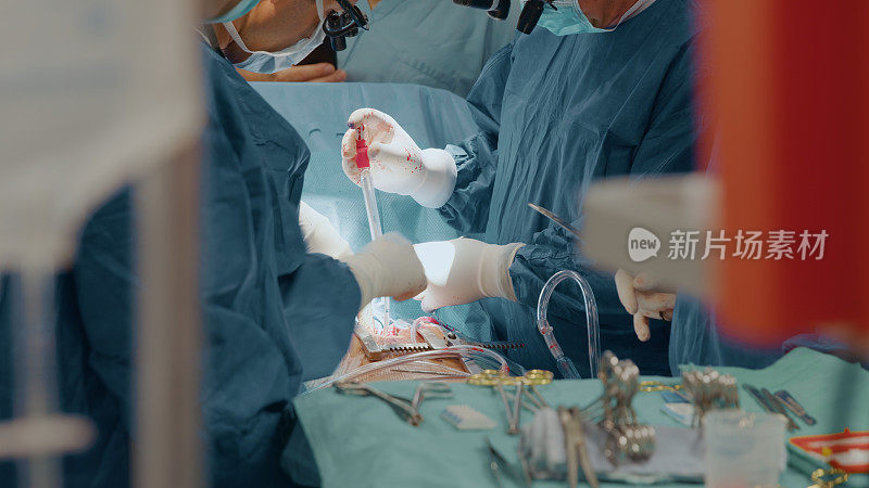 在手术器械的包围下对心脏瓣膜进行手术的一组外科医生
