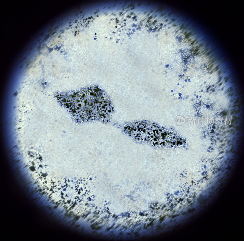 通过显微镜观察萨摩亚形状的细菌(系列)