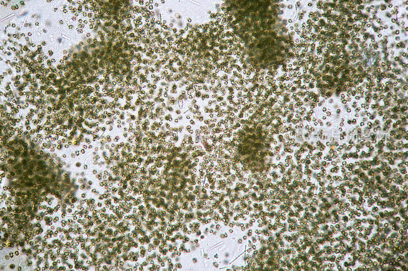 微囊藻蓝藻污染的藻类。用显微镜观察淡水浮游植物。水生命安全的生态问题