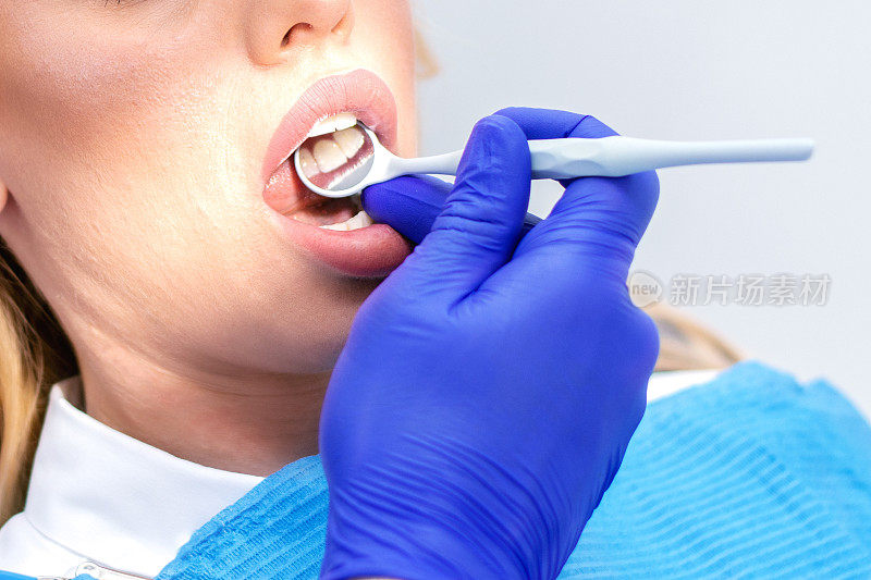 正在牙医那里检查牙齿的女人
