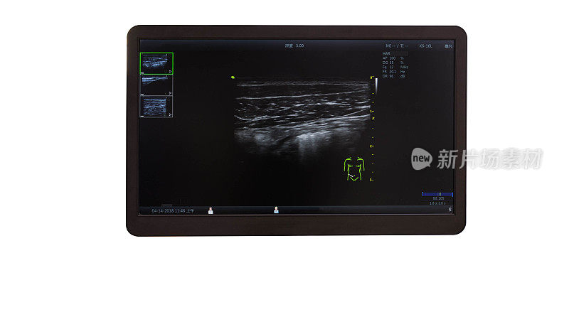 超声波医学检查液晶显示器