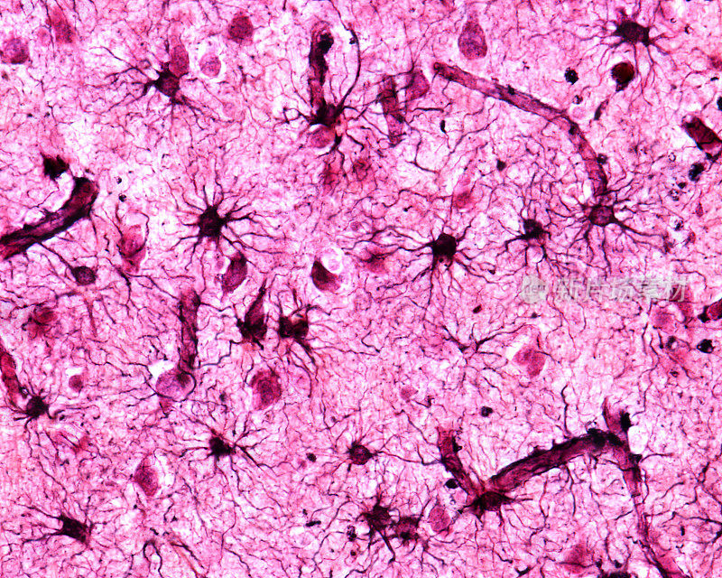 大脑皮层。原生质的星形胶质细胞