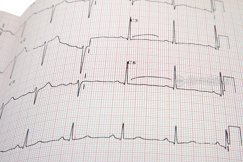 Сardiogram