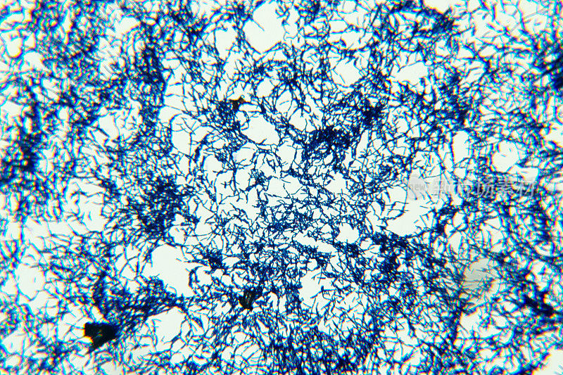 芽孢杆菌是革兰氏阳性的杆状细菌属，属于厚壁菌门。