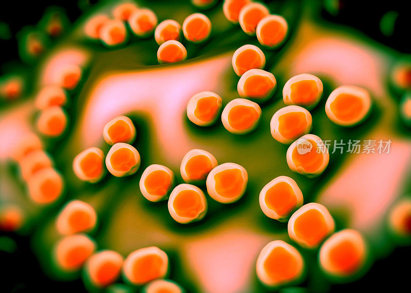 超级细菌或金黄色葡萄球菌(MRSA)