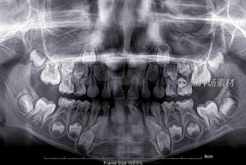 主要牙齿x射线