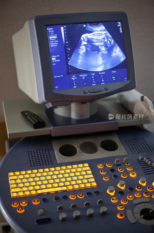 超声检查(即超声)机器与胎儿屏幕在医院