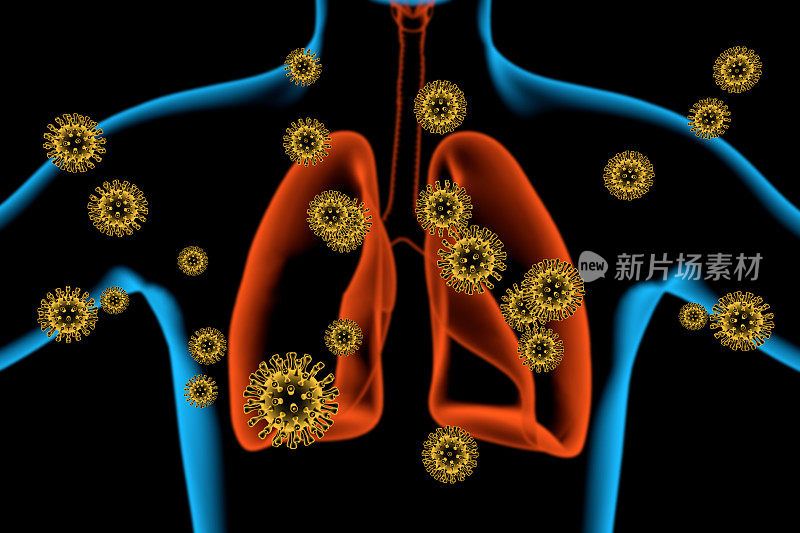 肺部:冠状病毒病COVID-19感染医学。冠状病毒疾病的新官方名称为COVID-19，在世界地图背景下的大流行风险