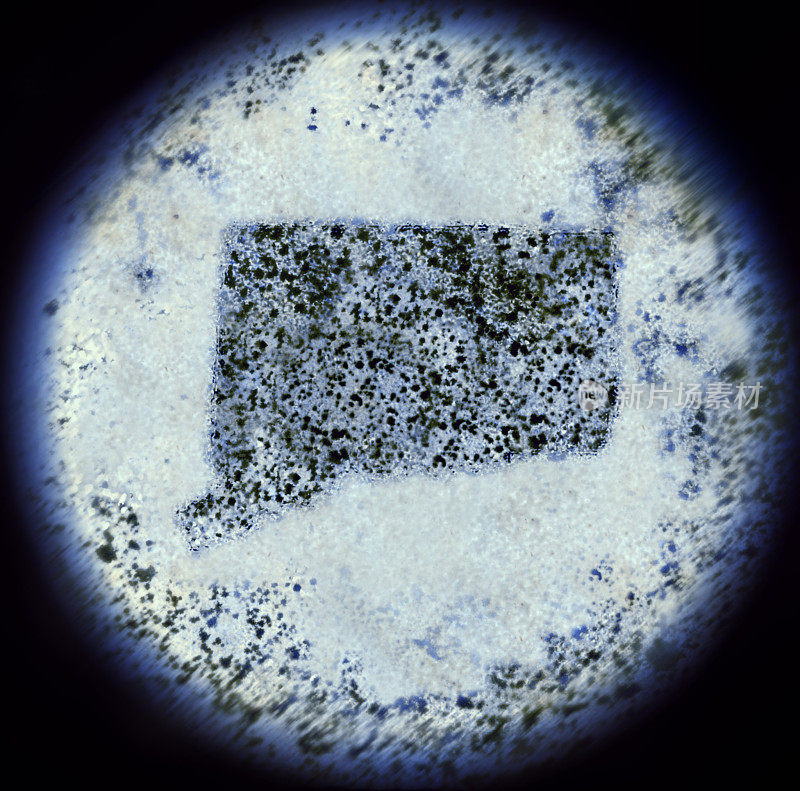 显微镜下的康涅狄格形细菌(系列)