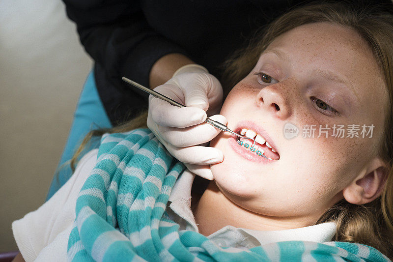 牙科助手使用探测仪器